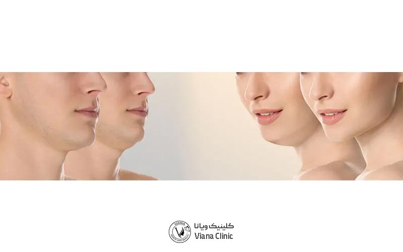 هدف از انجام ساکشن غبغب و تخلیه چربی چانه چیست