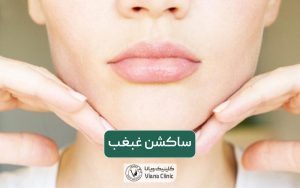 ساکشن غبغب چیست؟ صفر تا 100 عمل جراحی لیپوساکشن غبغب