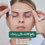 رفع افتادگی پلک ها با روش عمل جراحی بلفاروپلاستی و مزایای آن