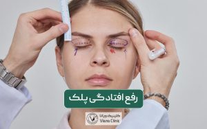 رفع افتادگی پلک ها با روش عمل جراحی بلفاروپلاستی و مزایای آن