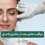 10 نکته مهم و طلائی مراقبت‌های بعد از بلفاروپلاستی