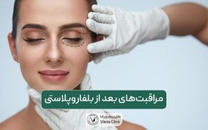 10 نکته مهم و طلائی مراقبت‌های بعد از بلفاروپلاستی