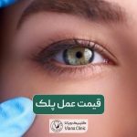 هزینه جراحی پلک و قیمت عمل بلفاروپلاستی در تهران سال 1403