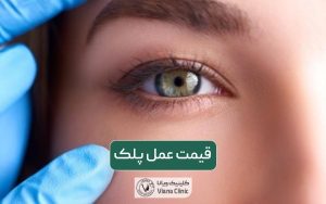 هزینه جراحی پلک و قیمت عمل بلفاروپلاستی در تهران سال 1403