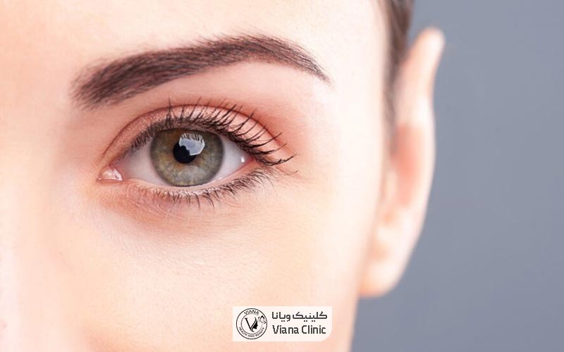 عمل تغییر رنگ چشم رنگی جهت زیبایی چشم در زن و مرد