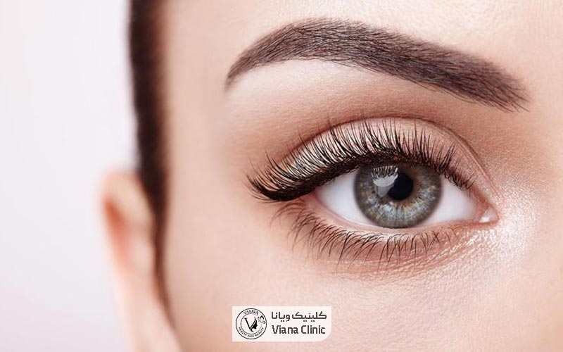 عمل زیبایی چشم چیست و چه کاربردی دارد