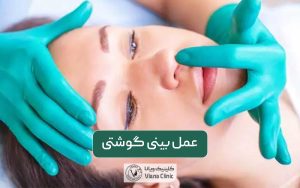 عمل بینی گوشتی و انواع مراحل و روش های جراحی بینی پهن و گوشتی