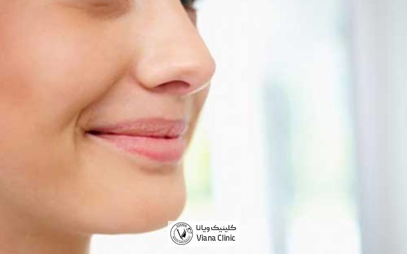 بهترین دکتر عمل بینی پهن و گوشتی در تهران و ایران در بهترین کلینیک تخصصی جراحی زیبایی بینی