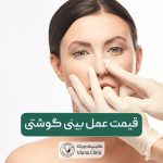 قیمت عمل بینی گوشتی در سال 1404 و عوامل موثر بر هزینه جراحی بینی پهن در تهران در سال ۱۴۰۴
