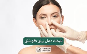 قیمت عمل بینی گوشتی در سال 1404 و عوامل موثر بر هزینه جراحی بینی پهن در تهران در سال ۱۴۰۴