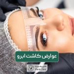 عوارض کاشت ابرو و راه های پیشگیری از آن