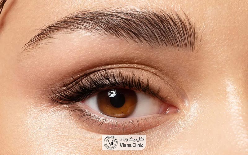 کاشت ابرو چیست و چه کاربردی دارد