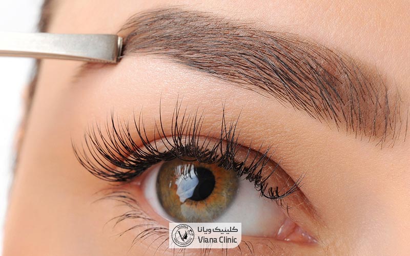 عوارض کاشت ابرو چیست و چگونه از آن مراقبت کنیم