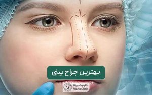 بهترین جراح بینی در تهران کیست و چه ویژگی هایی را دارد