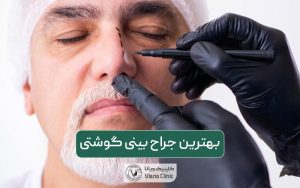 بهترین جراج بینی گوشتی و پهن در تهران کیست و چه ویژگی هایی را دارد