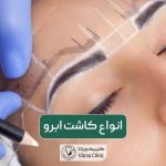 انواع کاشت ابرو و بهترین روش کاشت در ایران و تهران سال 1403