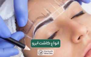 انواع کاشت ابرو و بهترین روش کاشت در ایران و تهران سال 1403