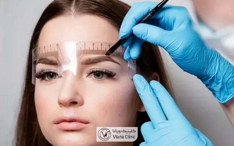 کاشت ابرو چیست و چه کاربردی دارد