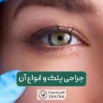 جراحی پلک چیست؟ انواع عمل زیبایی پلک و بلفاروپلاستی به همراه مزایا آن