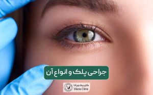 جراحی پلک چیست؟ انواع عمل زیبایی پلک و بلفاروپلاستی به همراه مزایا آن