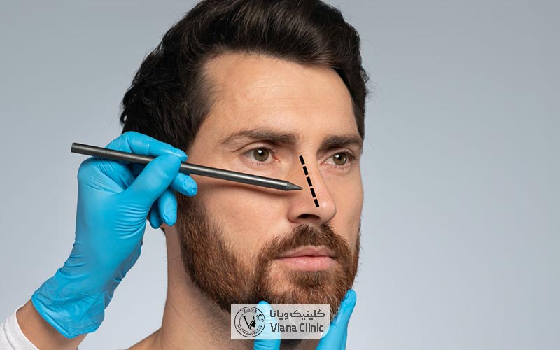انواع بینی استخوانی و نحوه عمل جراحی زیبایی و درمانی یا ترمیمی آن