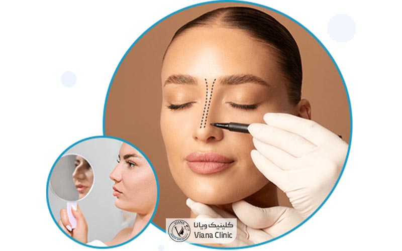 مقایسه تفاوت های بینی استخوانی و گوشتی و پهن در یک نگاه