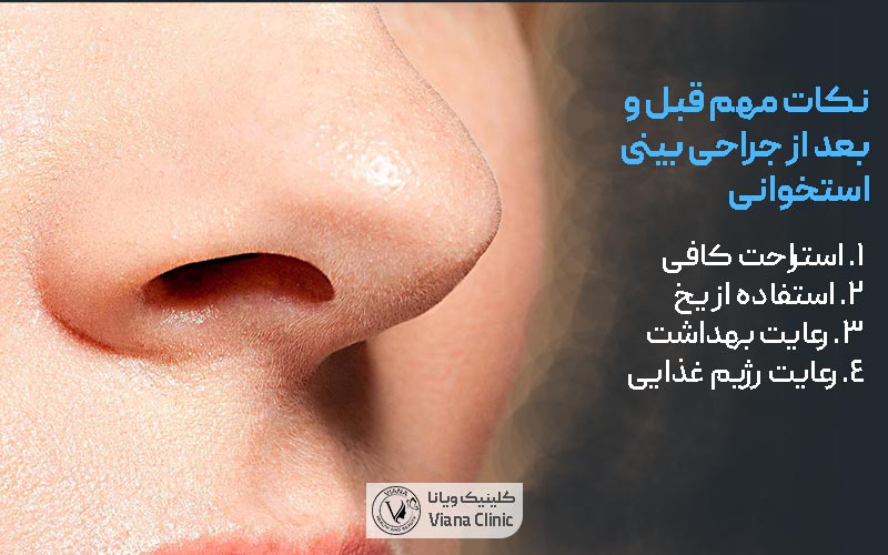 نکات مهم قبل و بعد از جراحی بینی استخوانی طبیعی مردانه و زنانه