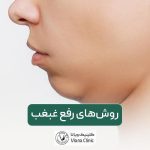 سریع‌ترین روش رفع غبغب و راه‌های از بین بردن آن