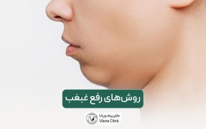 سریع‌ترین روش رفع غبغب و راه‌های از بین بردن آن