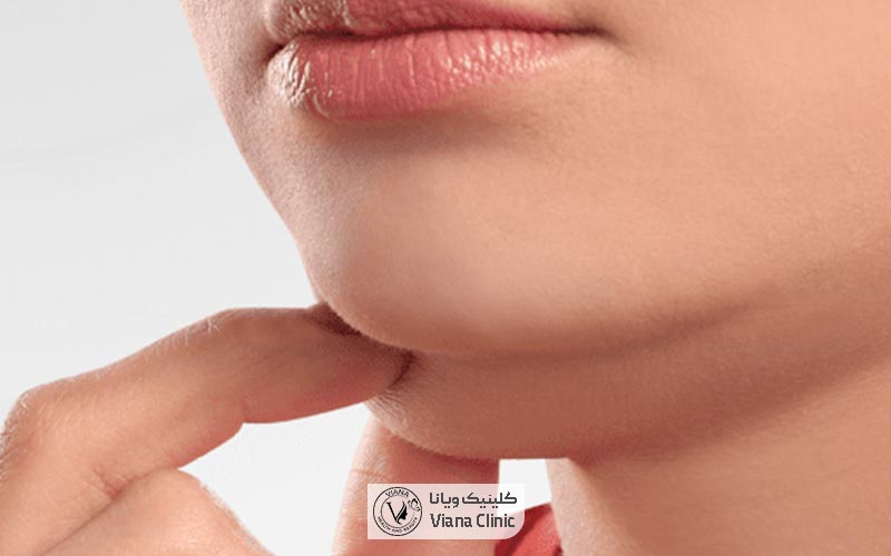 از کجا بفهمیم غبغب داریم؟ مراحل فهمیدن داشتن چربی اضافی در زیر گلو و گردن