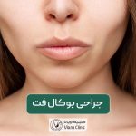 عمل جراحی بوکال فت چیست؟ عوارض و قیمت عمل تخلیه چربی دهان