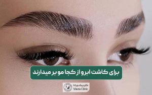 برای کاشت ابرو از کجا مو بر میدارند؛ بررسی نواحی بانک مو کاشتن ابرو