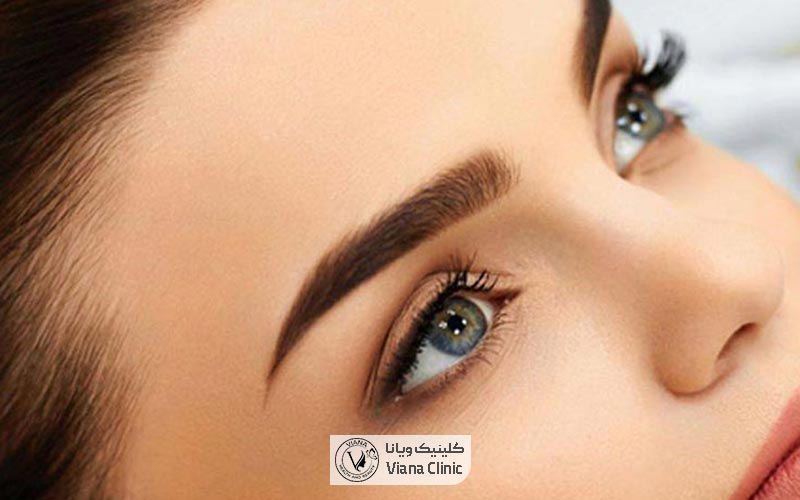 کاشت ابرو چیست و چه مزایایی را به همراه دارد