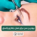 بهترین سن برای عمل بلفاروپلاستی زنان و مردان