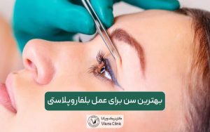 بهترین سن برای عمل بلفاروپلاستی زنان و مردان