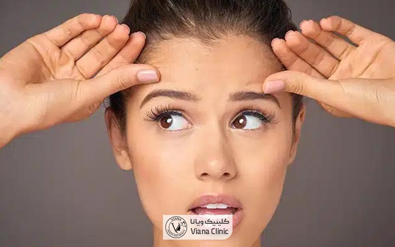 لیفت ابرو چیست و چه هدفی دارد