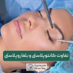 مقایسه و تفاوت کانتوپلاستی و بلفاروپلاستی در یک نگاه