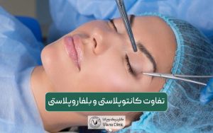 مقایسه و تفاوت کانتوپلاستی و بلفاروپلاستی در یک نگاه
