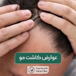 عوارض کاشت و بررسی تمام عواملی که زودهنگام و دیرهنگام بر کاشت مو عوارض دارند