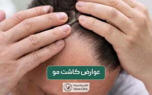 عوارض کاشت و بررسی تمام عواملی که زودهنگام و دیرهنگام بر کاشت مو عوارض دارند
