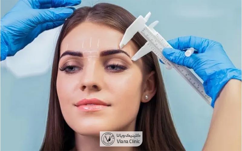 بهترین روش کاشت ابرو در ایران و مقایسه قیمت کاشت ابرو در سال ۱۴۰۴