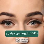 کاشت ابرو بدون جراحی و معرفی بهترین روش کاشتن آن بدون عمل