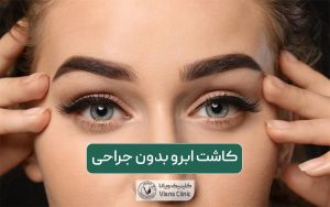 کاشت ابرو بدون جراحی و معرفی بهترین روش کاشتن آن بدون عمل