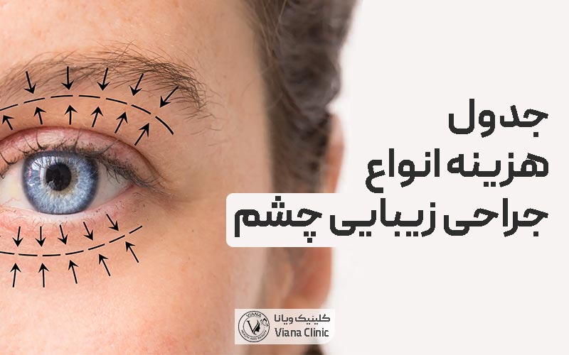 لیست و جدول هزینه انواع عمل جراحی زیبایی چشم زنان و مردان در سال 1404