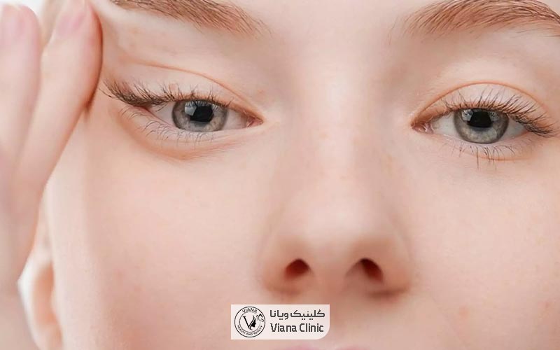 هزینه جراحی لیفت ابرو در ستارخان تهران چقدر است
