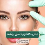 عمل کانتوپلاستی چشم (جراحی چشم گربه ای) و مزایا و عوارض آن