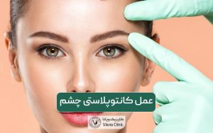 عمل کانتوپلاستی چشم (جراحی چشم گربه ای) و مزایا و عوارض آن