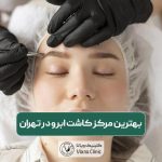 بهترین مرکز کاشت ابرو در تهران زیر نظر بهترین دکتر و پزشک در برترین کلینیک زیبایی