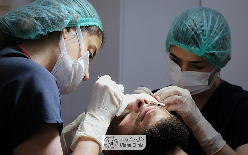ویژگی های بهترین مرکز کاشت ابرو در تهران چیست