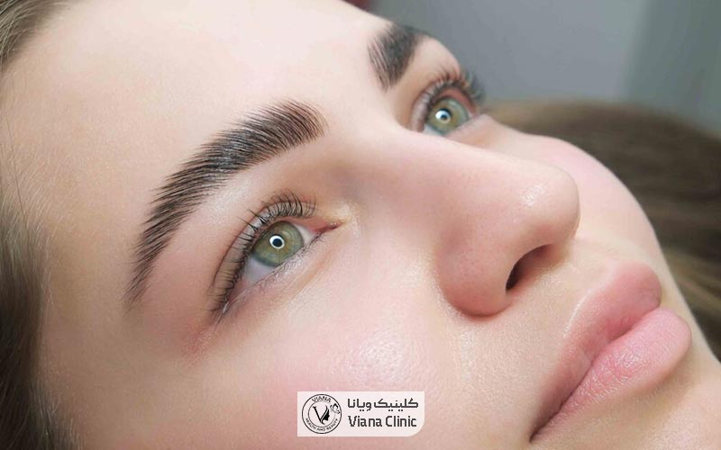 عوارض کاشت ابرو در یک نگاه